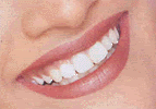 teeth © mould2005 lower teeth were too long